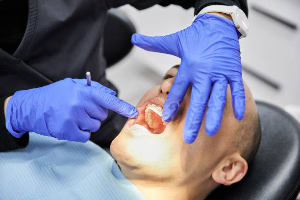 Best Emergency Root Canal Treatment in Des Peres, MO