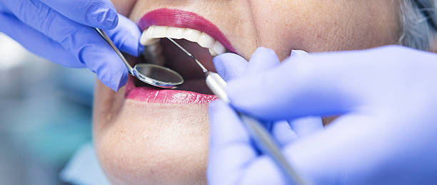 Best Emergency Dental Services for Seniors in Des Peres, MO